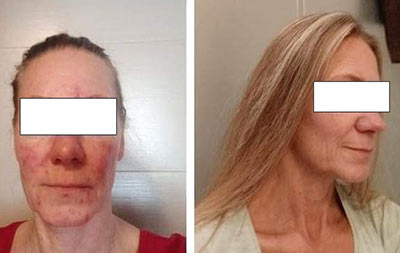 testimonials Root Wellness