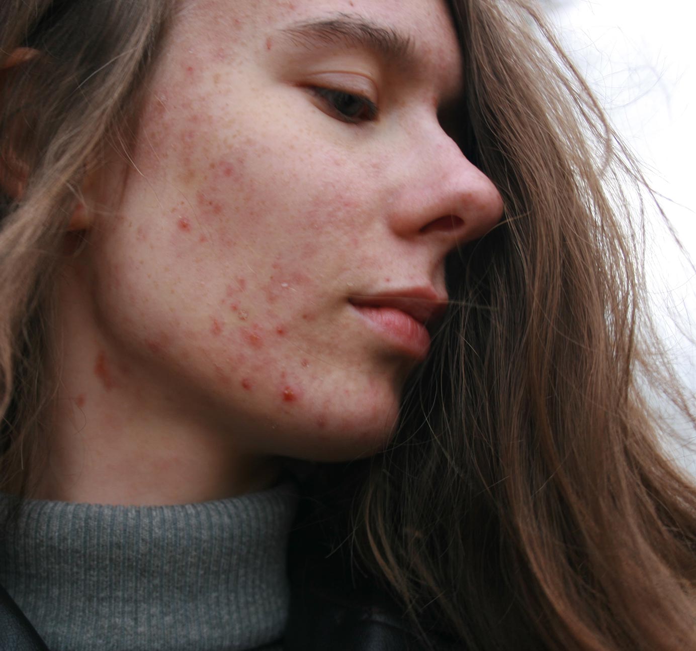 Heavy Metal Detoxification